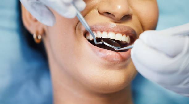 Best Cracked Tooth Emergency Dentist  in Monroe North, WA